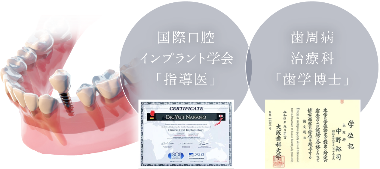 国際口腔インプラント学会「指導医」、歯周病治療科「歯学博士」